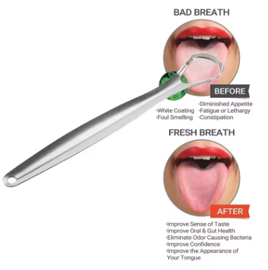 Tongue Cleaner